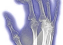 Thiết bị nội soi cột sống - Thiết Bị Y Tế Thành Phương - Công Ty TNHH Thành Phương