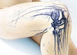 Thiết bị nội soi khớp gối - Thiết Bị Y Tế Thành Phương - Công Ty TNHH Thành Phương