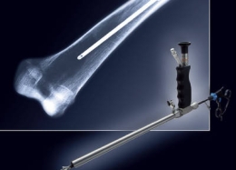 Thiết bị nội soi tủy xương