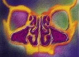 Nội soi xoang và tuyến yên - Thiết Bị Y Tế Thành Phương - Công Ty TNHH Thành Phương