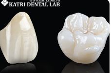 Răng sứ cao cấp - Thiết Bị Y Tế Katri - Công Ty CP Thiết Bị Y Tế Katri