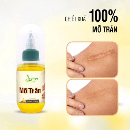 Mỡ trăn