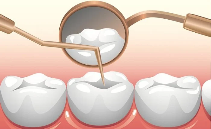 Dịch vụ nha khoa trẻ em