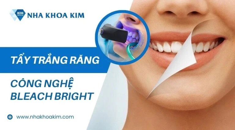 Dịch vụ tẩy trắng răng