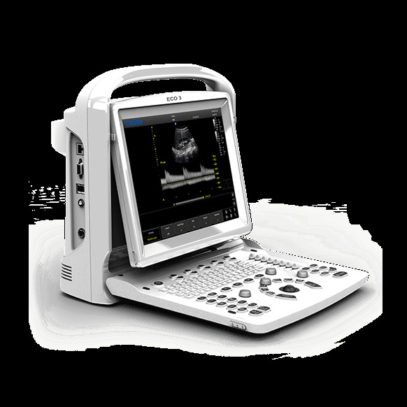 Máy siêu âm đen trắng - CHISON Medical Technologies Co., Ltd.