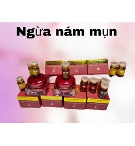 Kem trị nám dưỡng trắng da Ngọc Trinh - Spa Ngọc Trinh