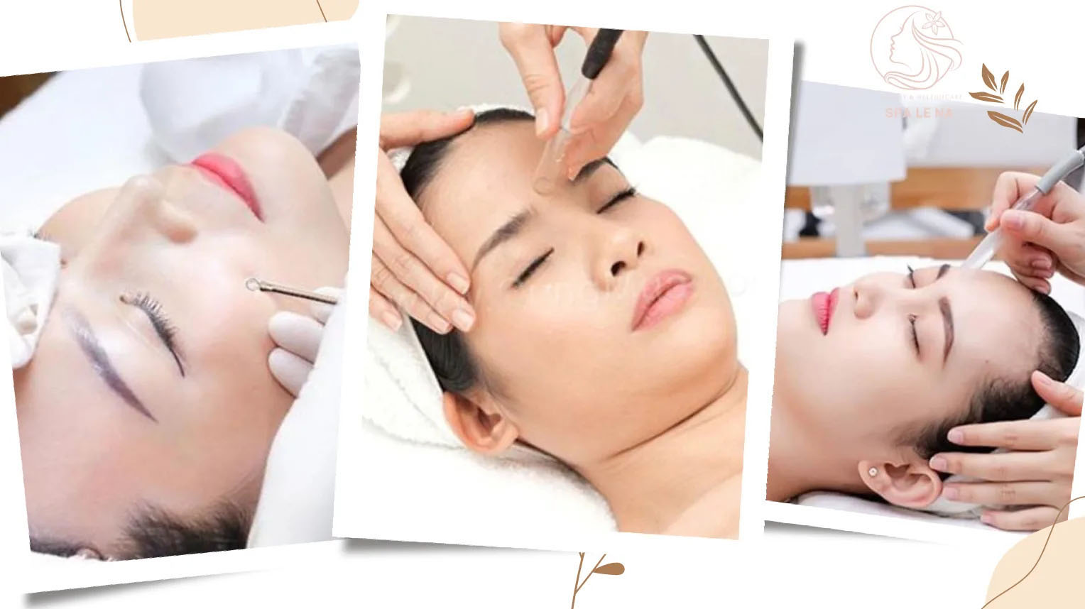 Lấy nhân mụn - Linh Na Spa - Công Ty Cổ Phần Thuận Tài Phát