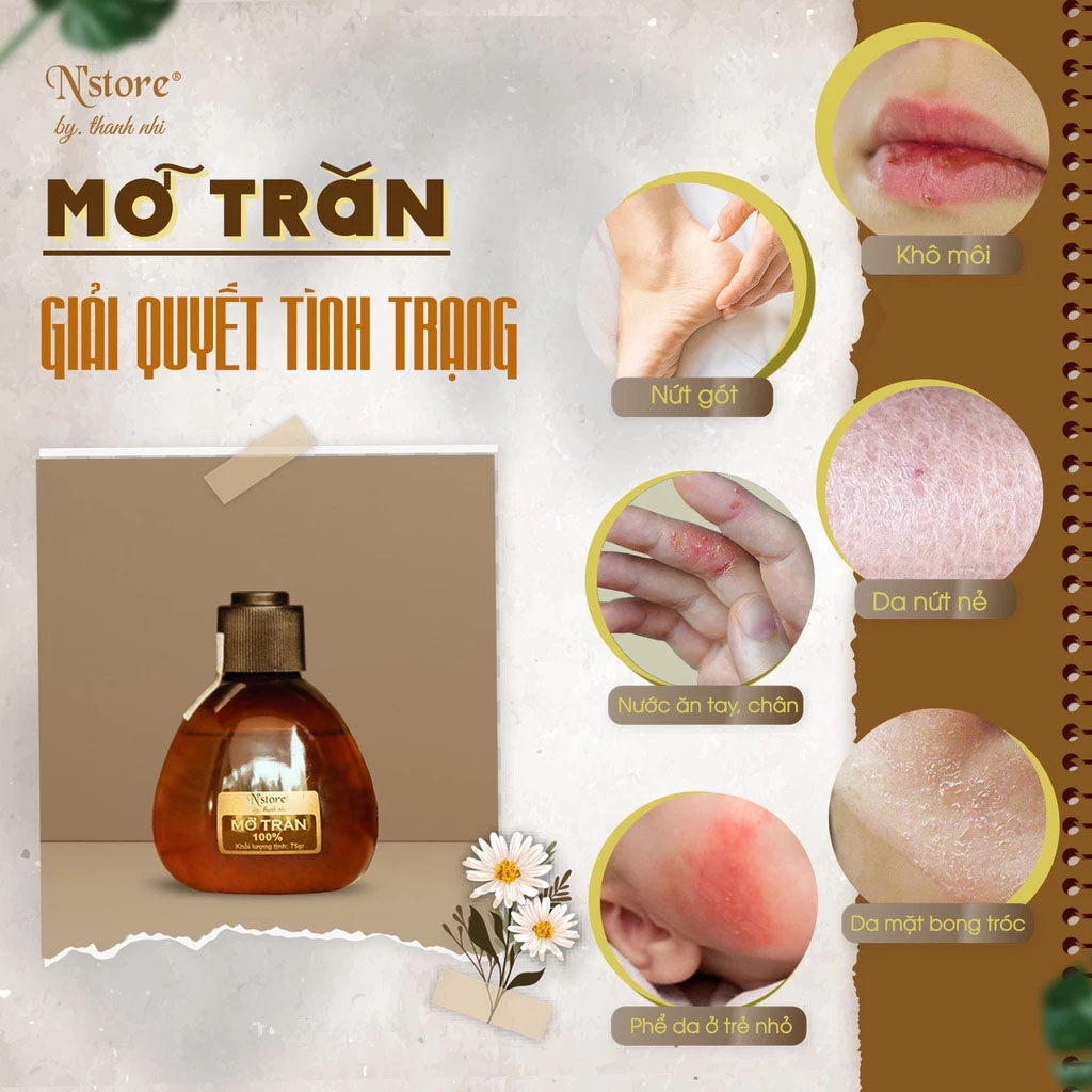 Mỡ trăn trị mụn - Linh Na Spa - Công Ty Cổ Phần Thuận Tài Phát