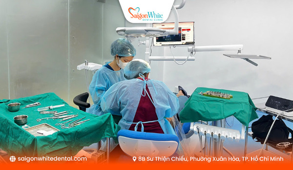Trồng răng implant