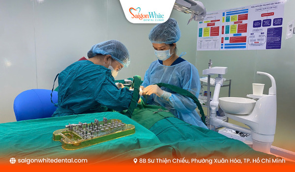 Trồng răng implant