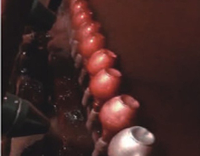 Chai xịt dạng cốc xoay - Dịch Vụ Sơn Phủ Xanh - Công Ty TNHH Công Nghệ Phủ Xanh