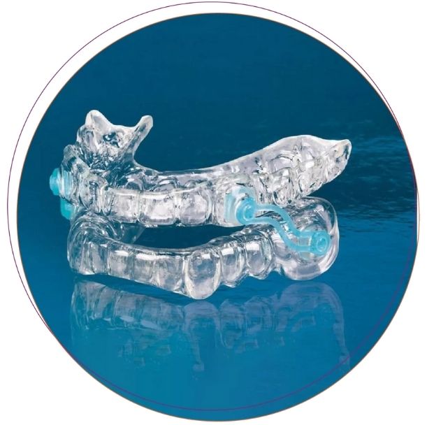 Đặt khí cụ chống ngáy