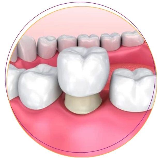 Làm răng sứ thẩm mỹ