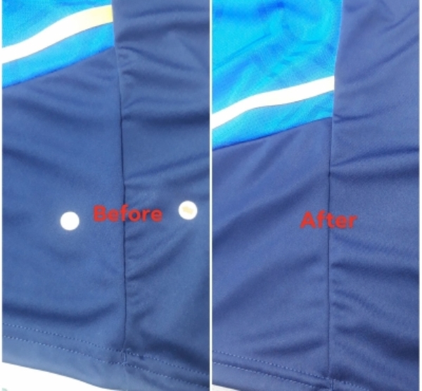 Dịch vụ xử lý quần áo